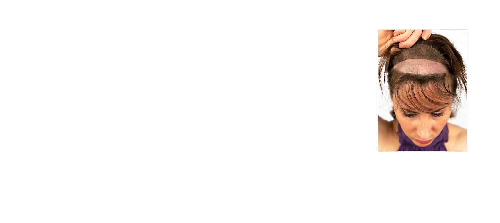 protese-capilar-feminina