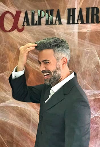 protese-capilar-masculina