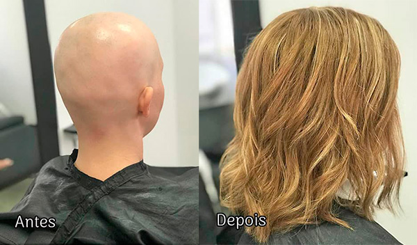 protese-capilar-feminina