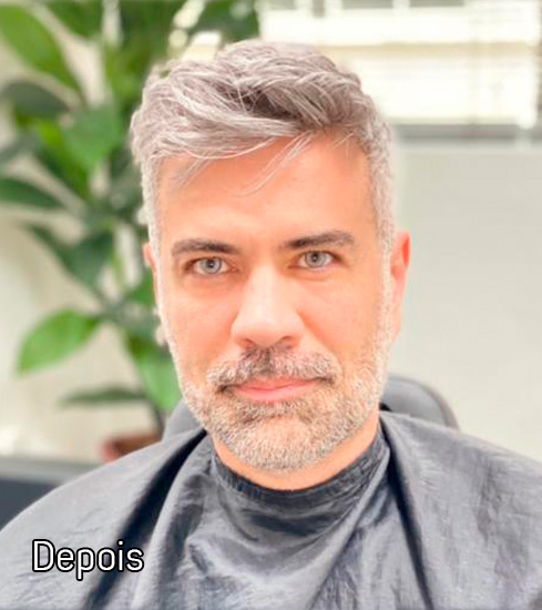 Protese-Capilar-masculino