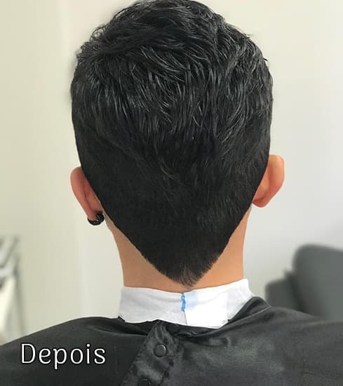 Protese-Capilar-masculino